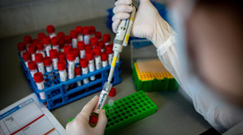 Bakan Selçuk: Corona virüs tedavisinde kullanılan ilacı geri ödeme listesine aldık