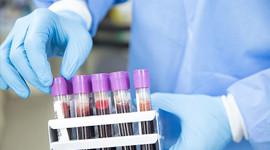 Aşıda dağıtım 1 yıl içinde olabilir mi?