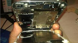 iPhone sahibini asitle yaktı!