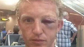 Ünlü futbolcu bu hale geldi!