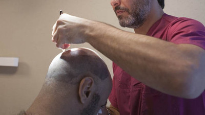 Saç ekim ekonomisi 1 milyar doları geçti