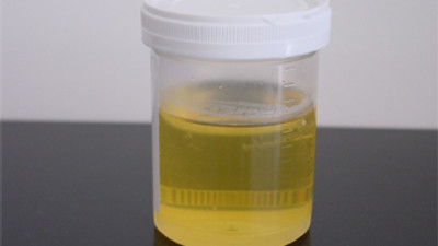 Çinliler idrardan beyin hücresi yaptı!