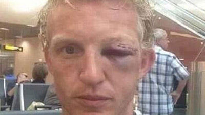 Ünlü futbolcu bu hale geldi!