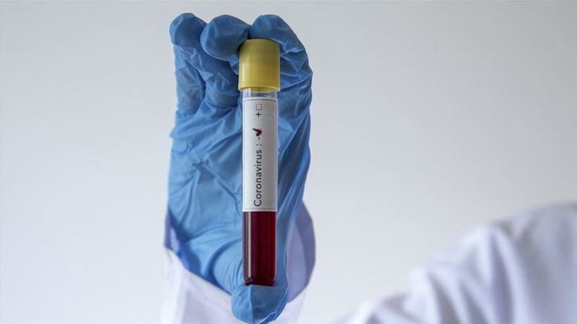 SGK’dan Corona virüsü tedbiri!