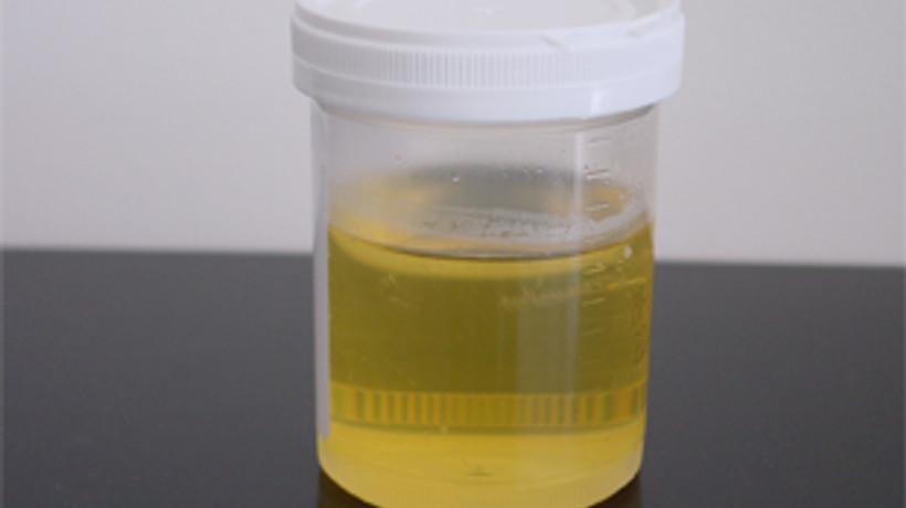 Çinliler idrardan beyin hücresi yaptı!