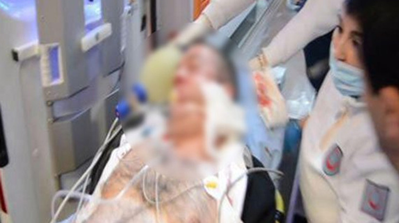 Hastane açıkladı: Ufuk Kıran'ın yüzünde kurşun girişi var