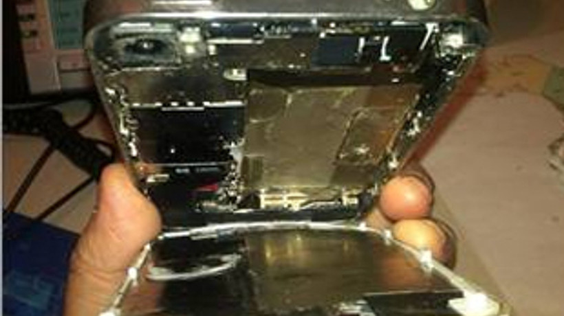 iPhone sahibini asitle yaktı!