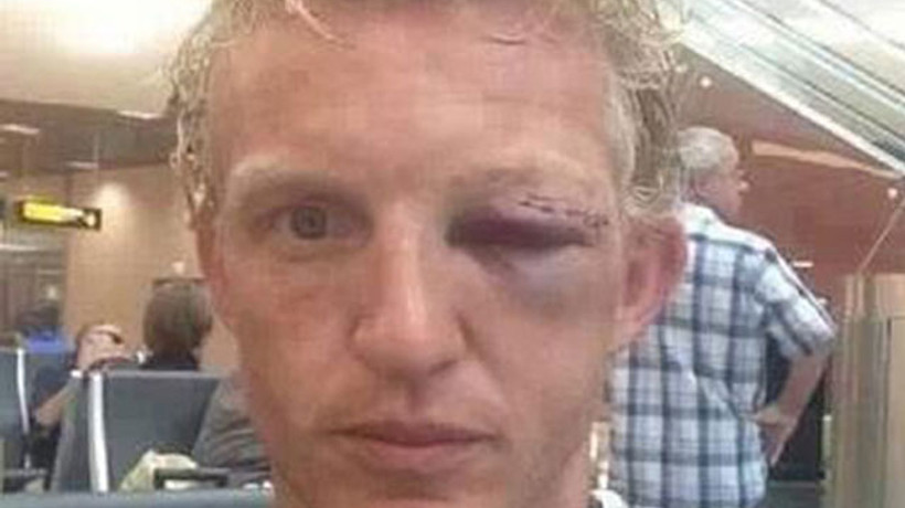 Ünlü futbolcu bu hale geldi!